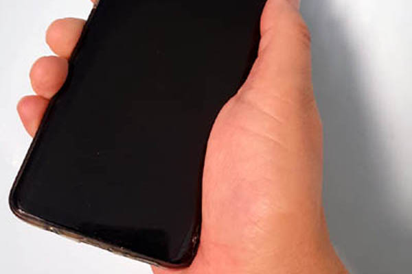 You are currently viewing  취미로 테니스를 즐겼는데 방아쇠 수지증후군이라고?