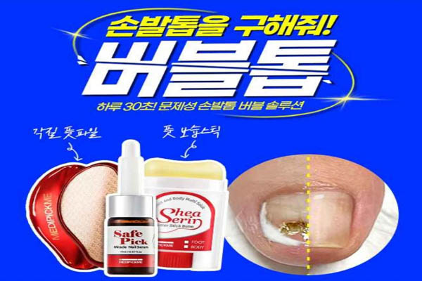 You are currently viewing 메디픽미 세이프픽 미라클 네이세럼 버블톱 손발톱 무좀